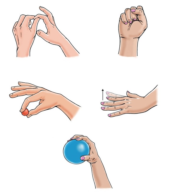 1. Как разрабатывать руку после перелома лучевой кости - изображение №1